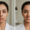 تخلصى الان من التصبغات